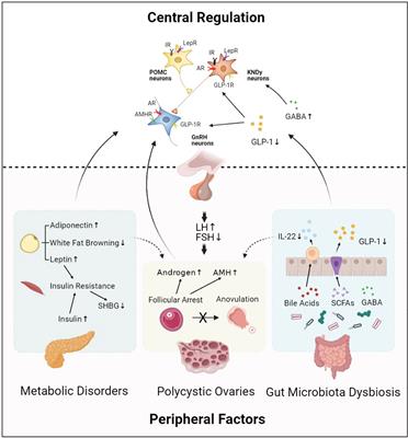 Central Regulation of PCOS: Abnormal Neuronal-Reproductive-Metabolic Circuits in PCOS Pathophysiology